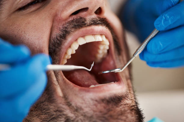 Best Emergency Treatment for Dental Infections or Abscesses in USA